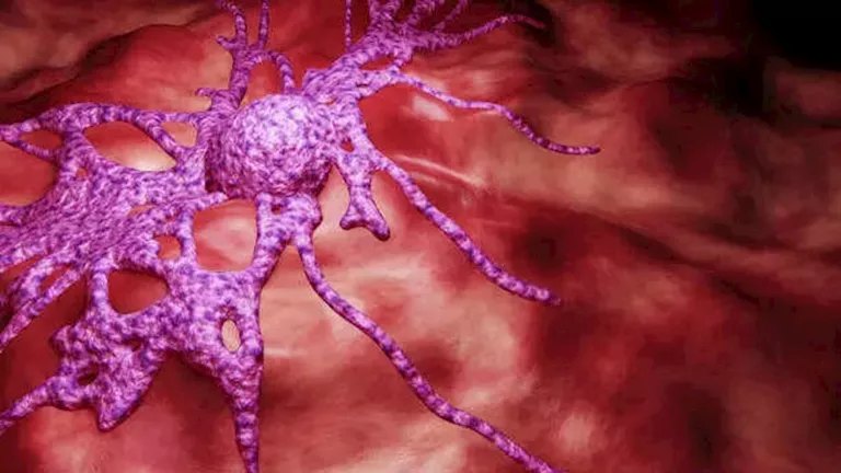 طبيب أورام يوضح عدوى فيروسية ترتبط بزيادة خطر الإصابة بالسرطان